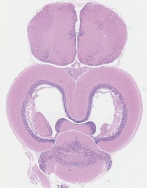 H & E stained saggital stickleback brain section with nuclei in purple and lipids in pink.