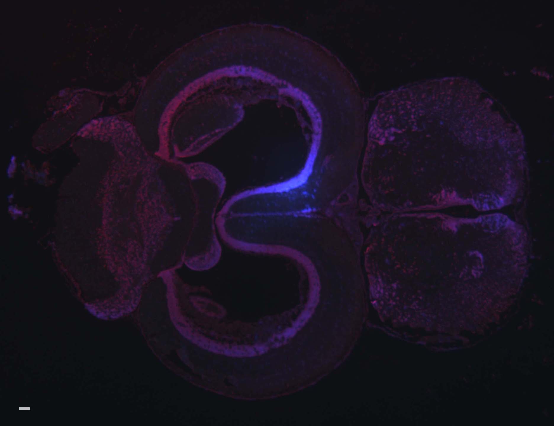 A fluorescent in situ hybridization on a thin slice of a threespine stickleback fish brain. A fluorescent in situ hybridization on a thin slice of a threespine stickleback fish brain. Pink is where the probe can be found while blue labels individual cell nuclei.