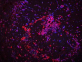 Staining of the brain in the brain of a threespined stickleback fish. Pink is where the probe is located and blue marks the cell nuclei.